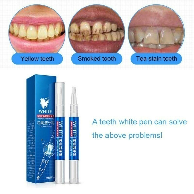 Dentist teeth whitening