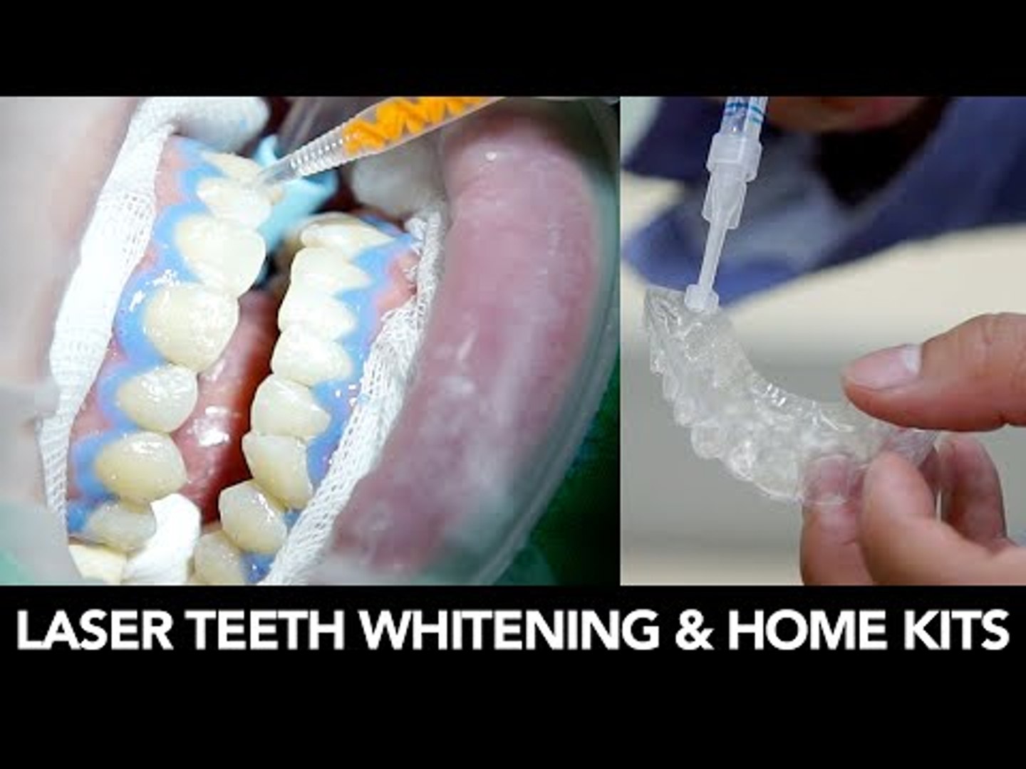 best of Teeth whitening dentist