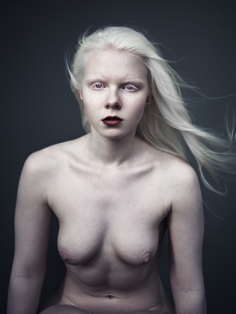 Albinos Porn Pics